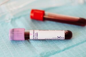 blood test