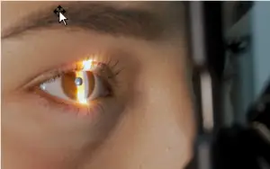 Eye Exam for GLP-1